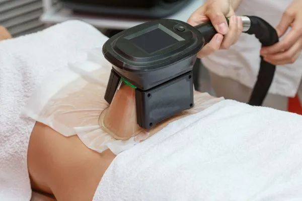 Image of person having fat freezing treatment to help weight gain Maplehurst