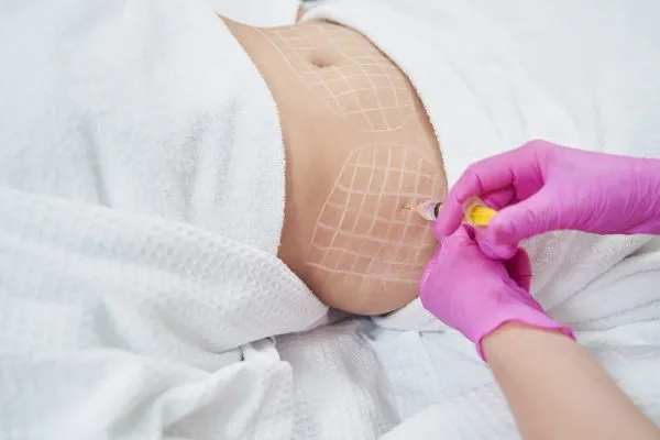 image of fat dissolving injections on love handles to help combat weight gain Maplehurst