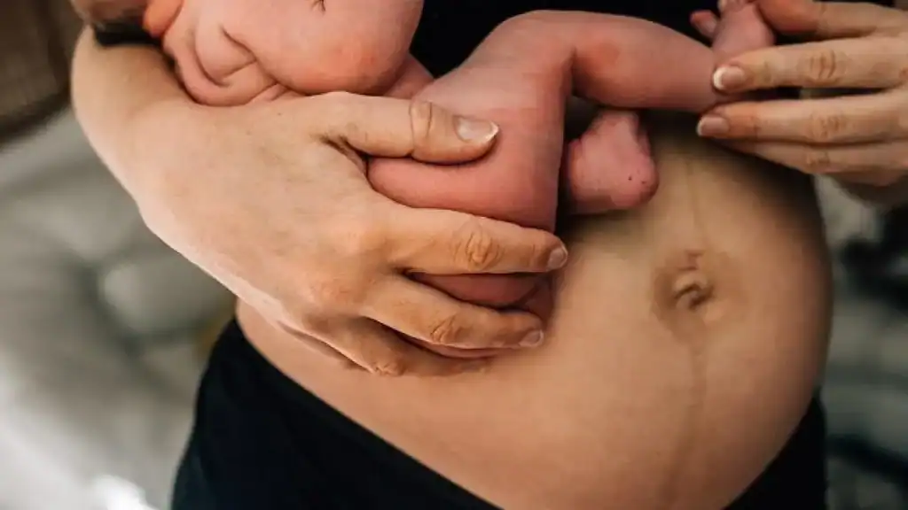 Why Is My Stomach Still Big After Pregnancy Maplehurst?